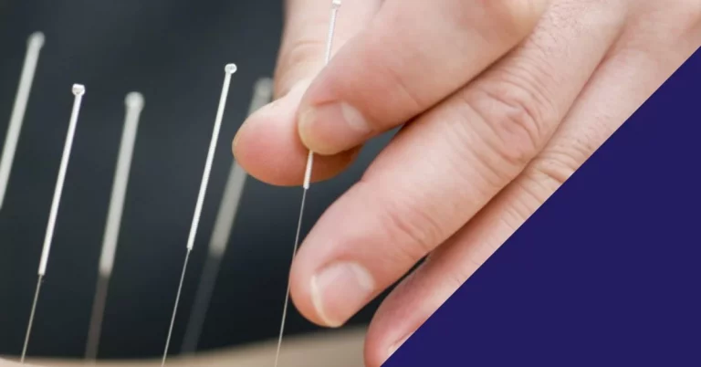 Your Dry Needling Questions Answered!