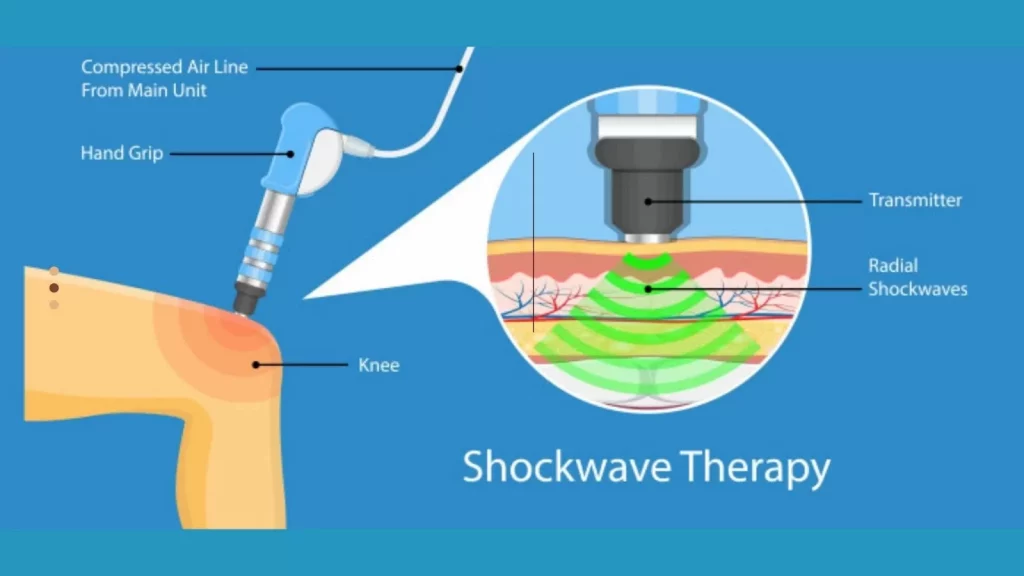 shockwave therapy aspire.jpg